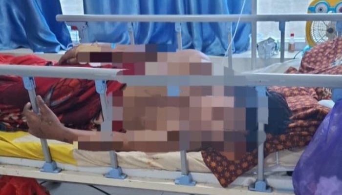 Sempat Viral, Pasien Ditandu 27 Kilometer di Kalumpang Meninggal Dunia
