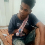 Warga Mengaku Dianiaya Security perusahaan sawit Pasangkayu